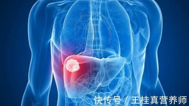 养肝护肝|身体出现2黄1痛，或是肝炎转癌的症状，医生：不可小觑