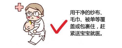 伤口|孩子烫伤后只有2分钟紧急处理,做错这一步,可能加重孩子的伤情