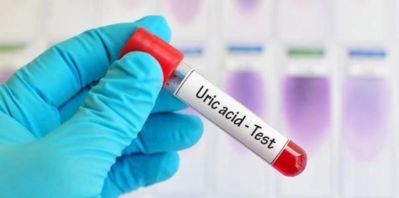 玉米须|尿酸高的人,2种食物再馋要忍住,多吃3物,降尿酸,痛风绕道走