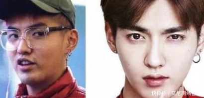 整形后脸部僵硬的当红男星 唯独他大方承认 快资讯