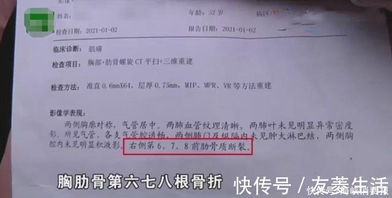 剖腹产|女子产后胸部剧烈疼痛，一个月后才知道，断了三根肋骨
