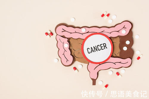 肠道|经常放屁是肠癌的警示吗？肿瘤科医生说：这4个症状才是肠癌信号