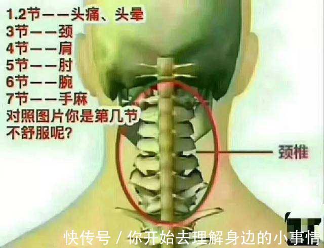 头颈部|生姜盐水，不出二周，头晕手麻不见了，连颈椎病肩周炎也消了！