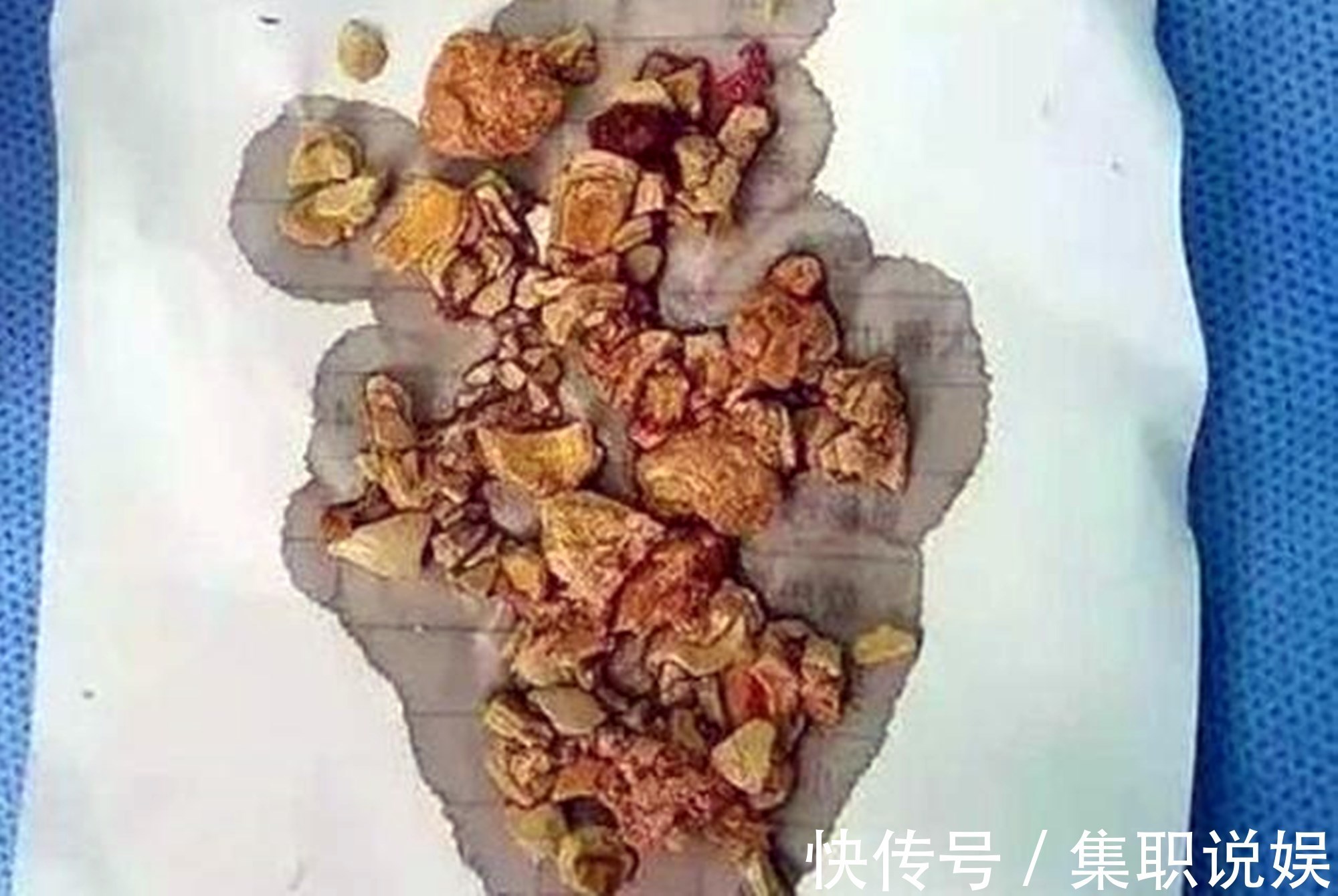 偷懒|宝妈的这种“偷懒辅食”,看似喂饱孩子实则没营养,还会造成积食