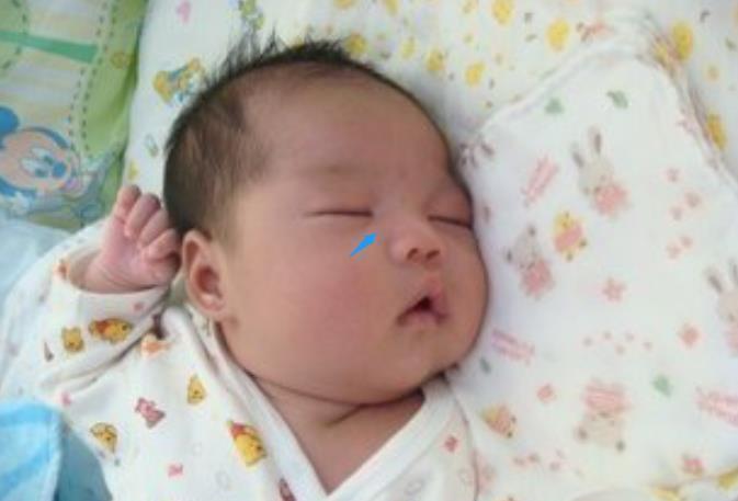 宝宝|宝宝的鼻梁何时“定型”?塌鼻梁的娃想“逆袭”,要满足哪些条件