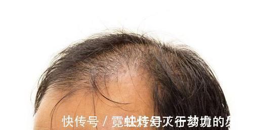 中老年|男人50岁后,身上若没有出现这4种表现,还不错,长寿或偏爱你