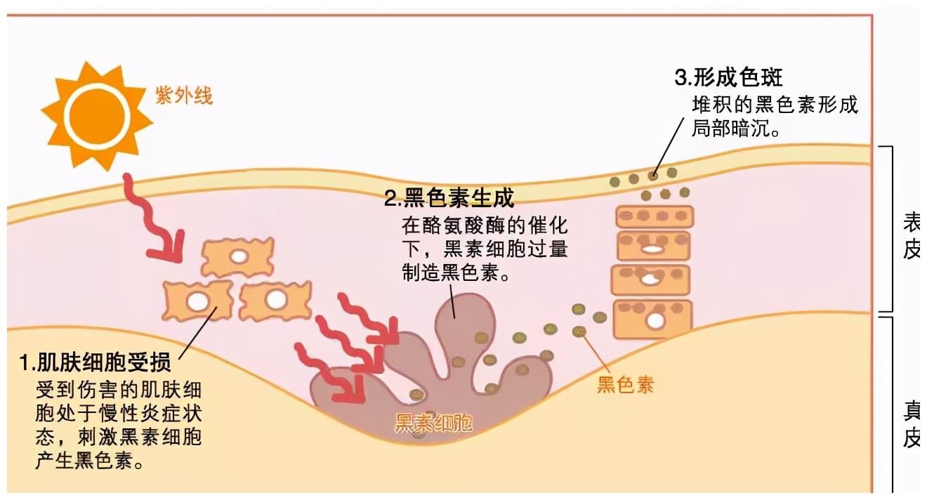 「未来医生」不想变黑，除了防晒，还应该这样做