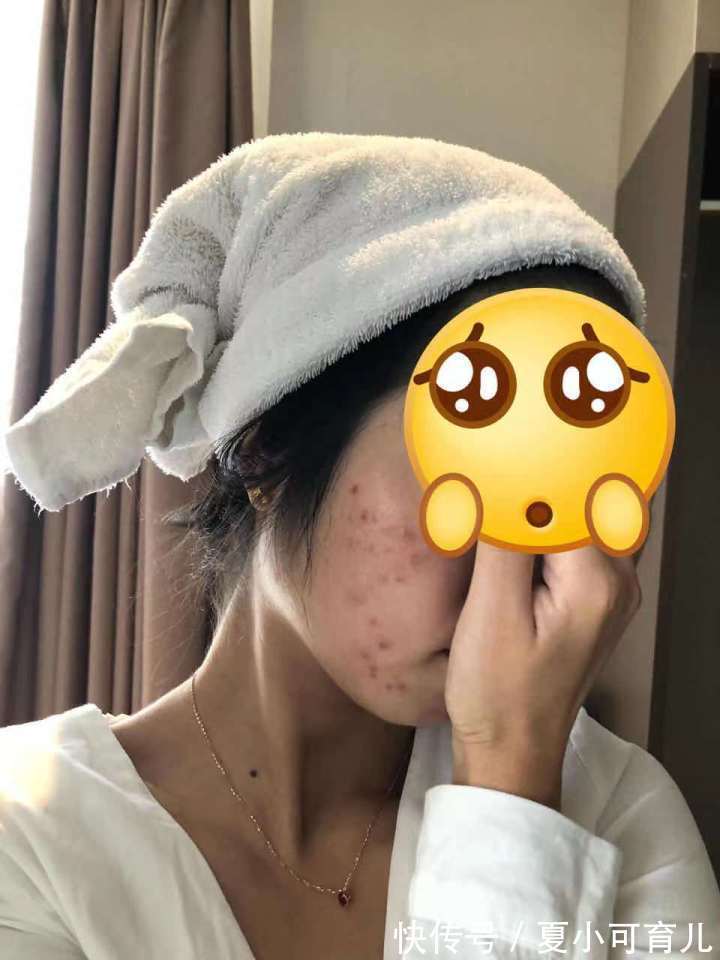 珂润|盘点5款好用不贵的宝藏级护肤品,效果不输大牌,孕妇可用