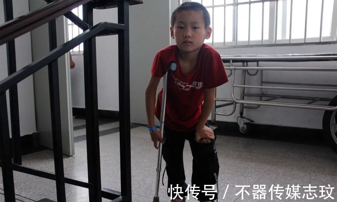 小志兴|男童骨折后不敢说导致残疾,妈妈离去,耳聋爸爸携其求医4年