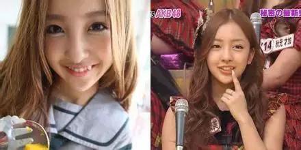 日本|为什么很多日本女孩的牙不整齐