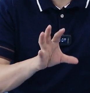 颈椎病|手指运动不灵活就是颈椎病吗？错！医生：要区分锥体外系疾病！