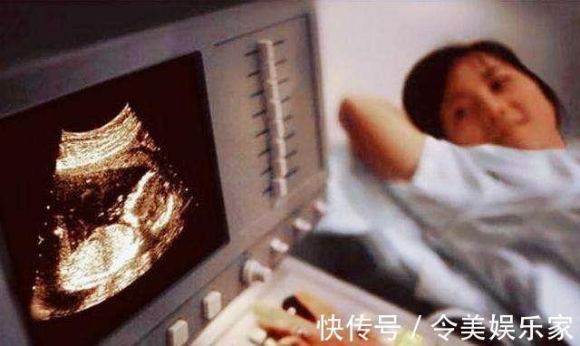 畸形|孕期孕妈最多能做几次B超超过此上限,会给女宝带来一大隐伤