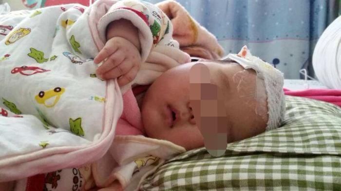 孩子|2岁儿子总摸头,妈妈觉得不对劲带娃去检查,医生感叹幸亏发现早