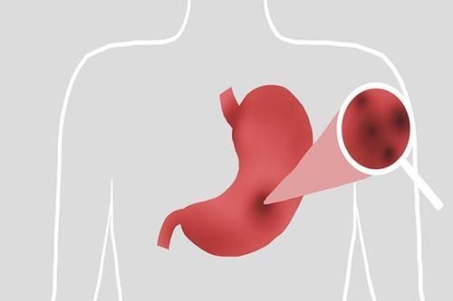 营养均衡|125斤女子，5天没吃饭，瘦了多少斤？减肥的你一定要看