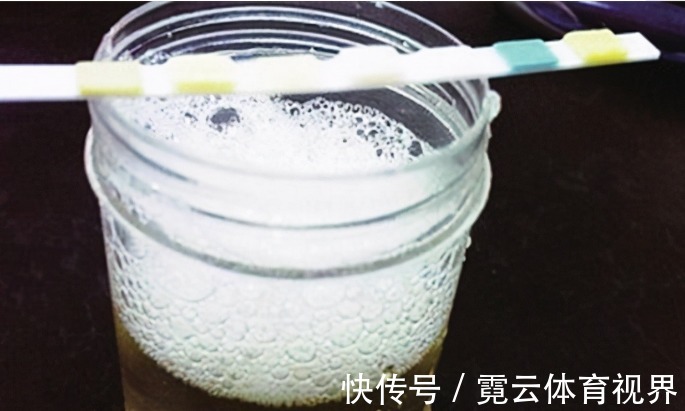 血糖升高|上厕所后,出现3种情况,说明你的血糖高了!糖尿病患者要注意