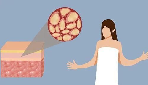 为什么有人是油耳朵,有人是干耳朵?有哪些区别?