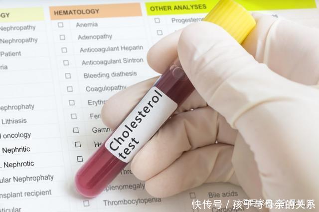 走到|心内科主任直言:从高血脂走到脑梗只用了半年,2种食物吃太多