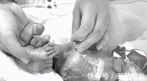 济南第二医院|32岁孕妇舍命生五胞胎,最小的仅鸡蛋一般大,令人揪心的纪录片!