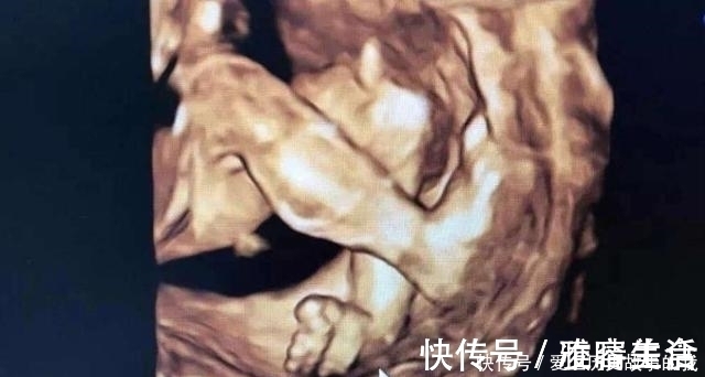 正常值|四维彩超，孕妈们最期待的产检，除了看宝宝的照片还需要看什么？