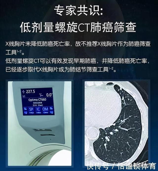 异常|肺部有癌,睡眠当知,睡觉时这些“异常”出现,尽快去医院排查