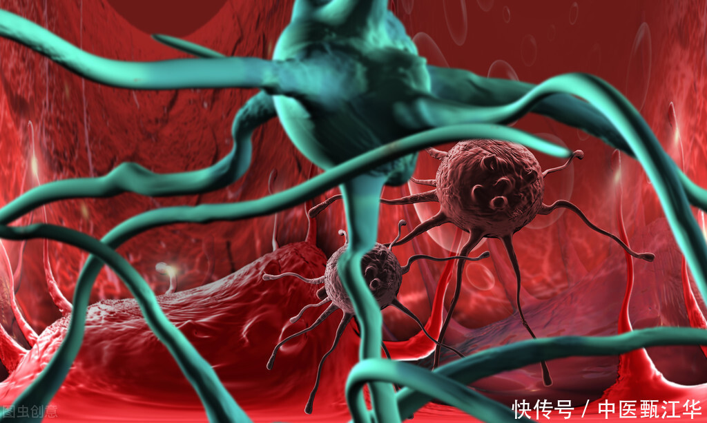  转移|易转移和复发的癌症，中医直言：做到2点，或有效预防