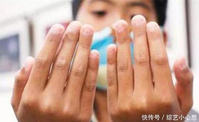 家长|小时候爱''咬指甲''的孩子,长大后多半是这2种性格,太心疼孩子了
