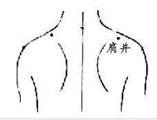 百治不如一刮!10种刮痧法,刮走全身疾病,用勺子就能做!不看真亏!