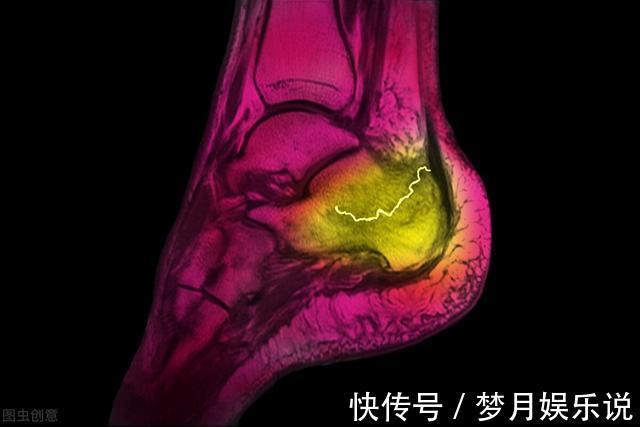 养生|医生提醒:70岁后想健康长寿,避开4个“养生”误区,否则很伤身