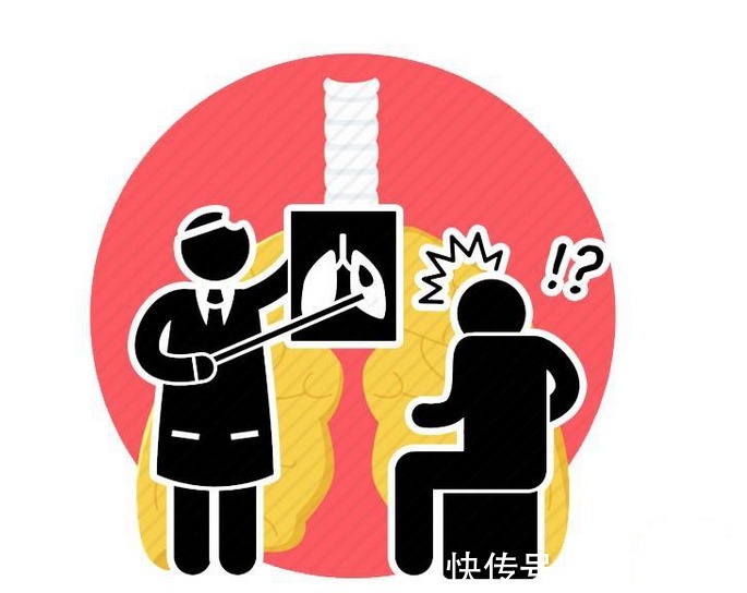 肺部|预防肺癌体检少不了!医生告知:筛查肺病,这项检查不能少!