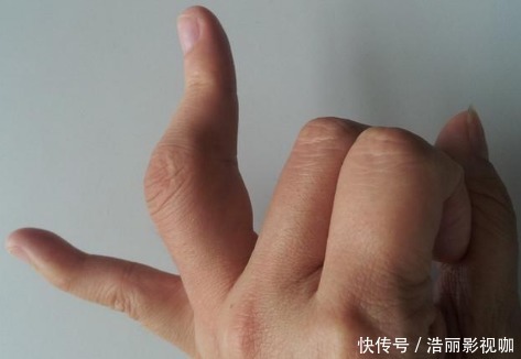 老中醫(yī)1個雞蛋+玉米,兩周尿酸降到280,“痛風(fēng)”也趕緊跑了