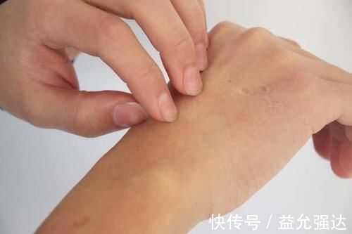 患者|癌症患者,用靶向药物,对身体有何影响?提早了解,更好应对