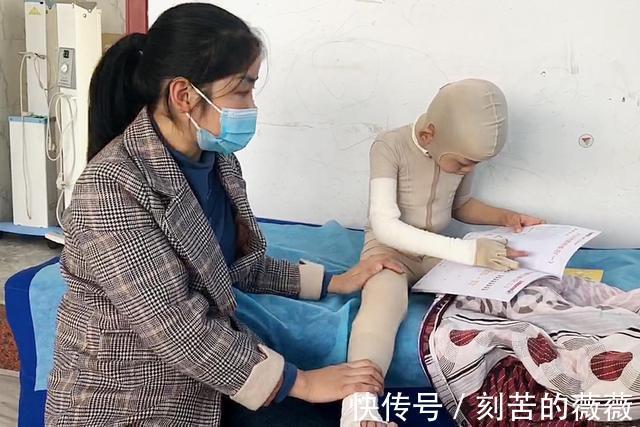 太阳能|热水器老化爆裂烫伤6岁男孩,治疗费已超百万,家长始终不愿放弃