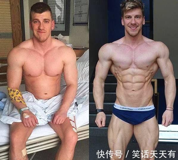 冠军|26岁健美冠军,小腿突发意外,体脂太低是“原罪”