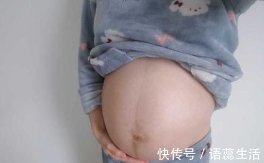 疼痛|剖腹产时,这些弊端也要面对,你都了解吗