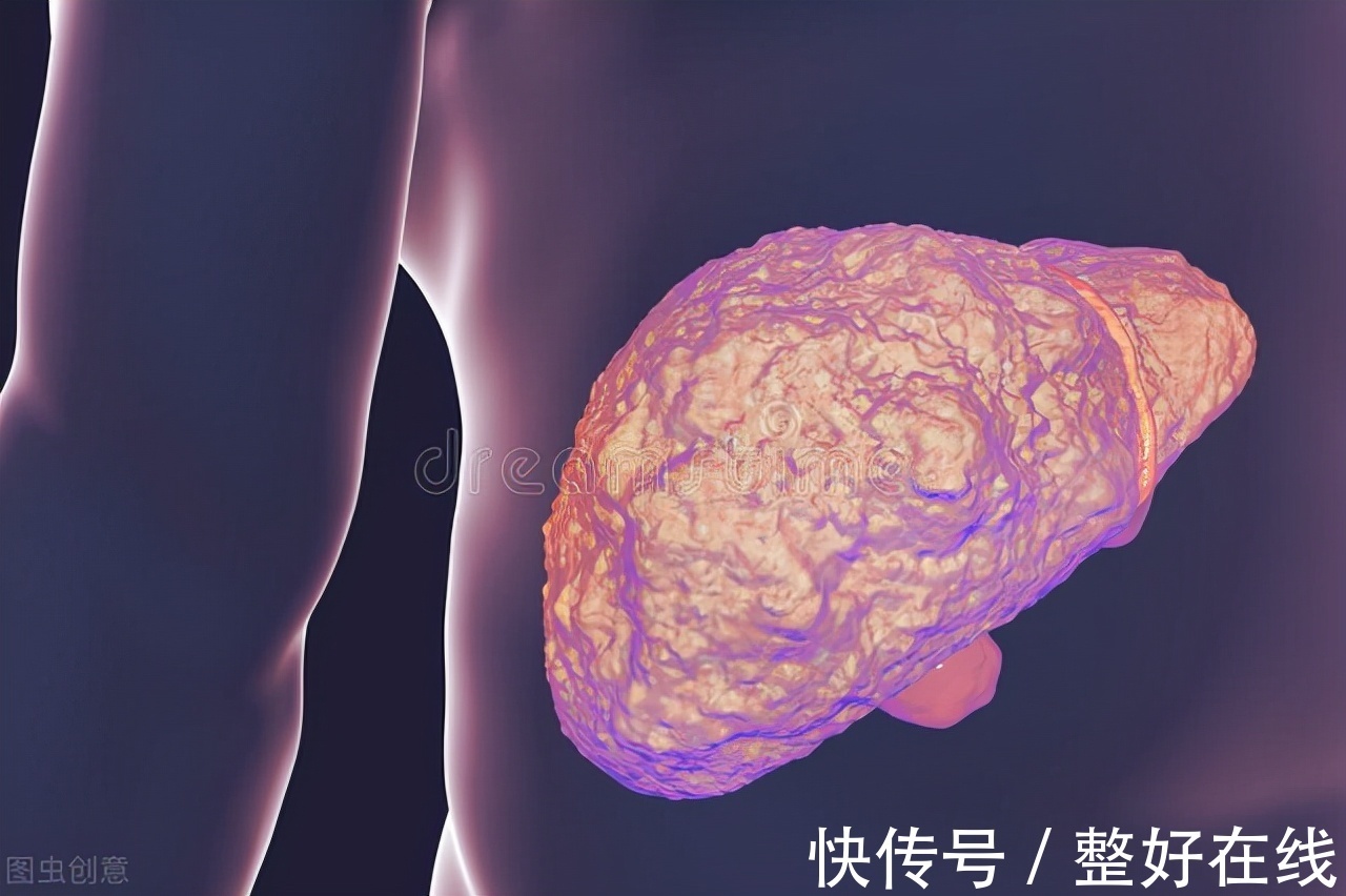 日常生活中|得了肝硬化怎么办?专家饮食上给你推荐“4招”,帮你缓解肝硬化