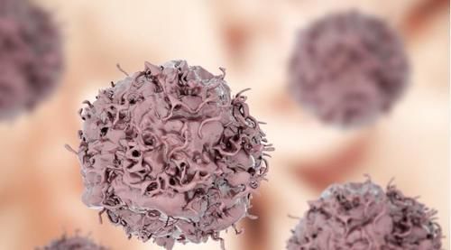 会长时间|五十岁以后更容易长肿瘤?老年人要留意这些症状,出现后及时检查