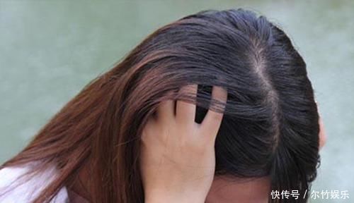 头皮上抠出很多“白泥”，只是头皮屑，还是螨虫在头上扎窝了