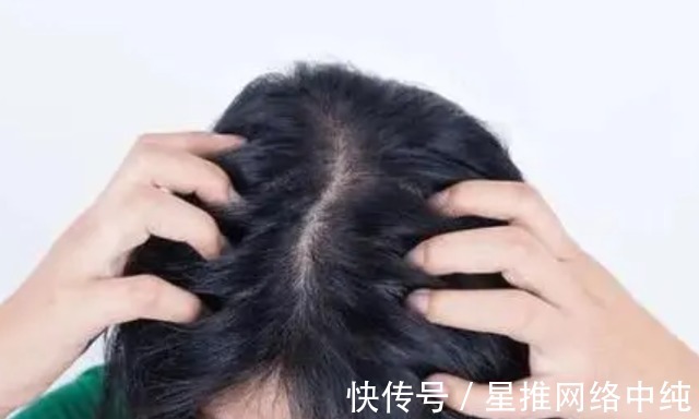 硫磺皂|用硫磺皂洗头发有哪些好处,需要注意哪些事项呢?