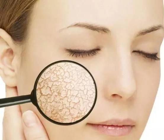 “以油养肤”才是干皮的生存之道,不要再执着于“补水”了!