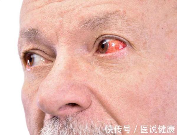 肝脏受损|肝脏不好,身体这4处有异常!养护肝脏,牢记这5点,别忽视