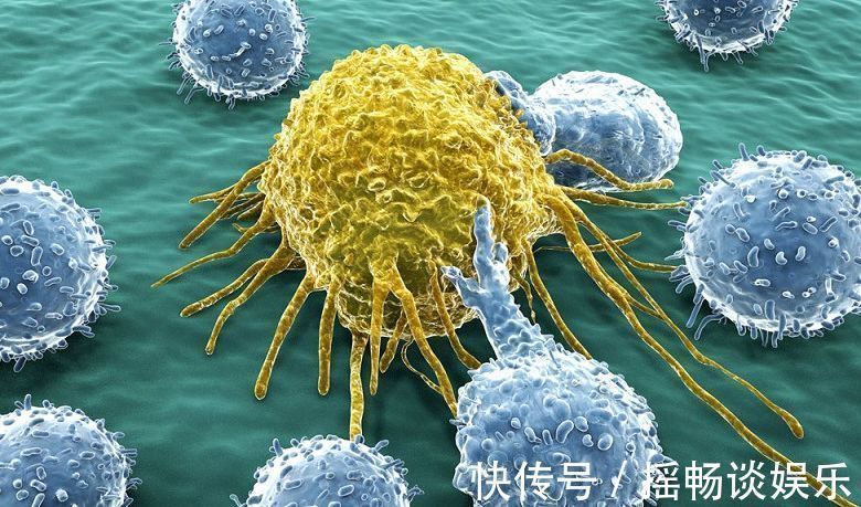 pet|年年体检,为什么还会得癌症?普通体检查得出来吗?