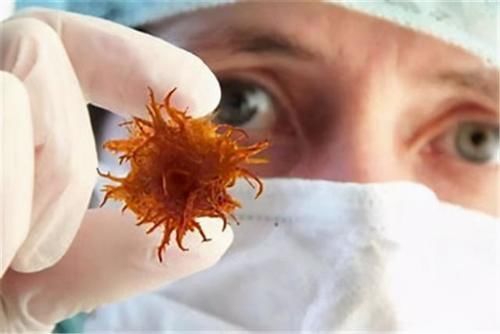 肿瘤细胞|肿瘤一般治不好,能治好的都是误诊了?肿瘤医生说出了心里话
