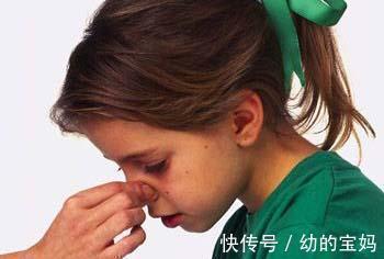 动作|3岁男孩鼻出血因一个错误动作去世,医生提醒:应该这样正确应对