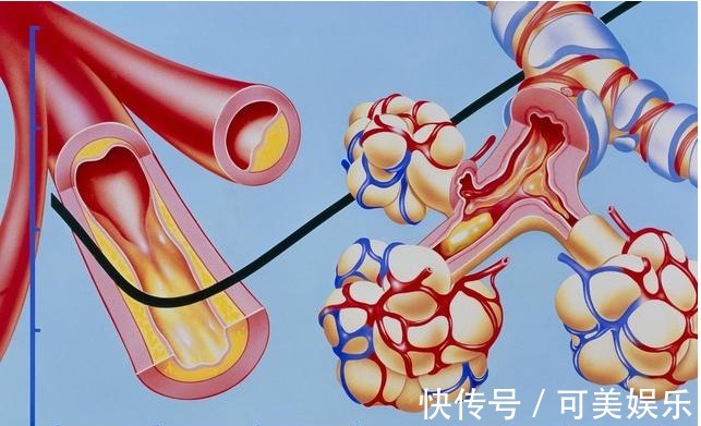 血管|98岁中医,血管再堵,用对这个方法,快速解决高血脂,用1个好1个