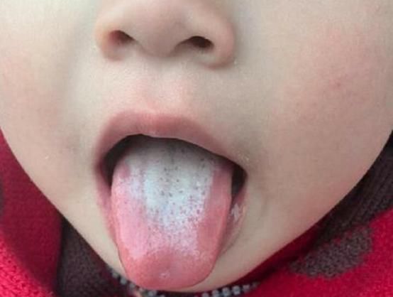 饮食健康|9岁女孩一年长高20厘米,儿科主任:这习惯不错,父母们都学学