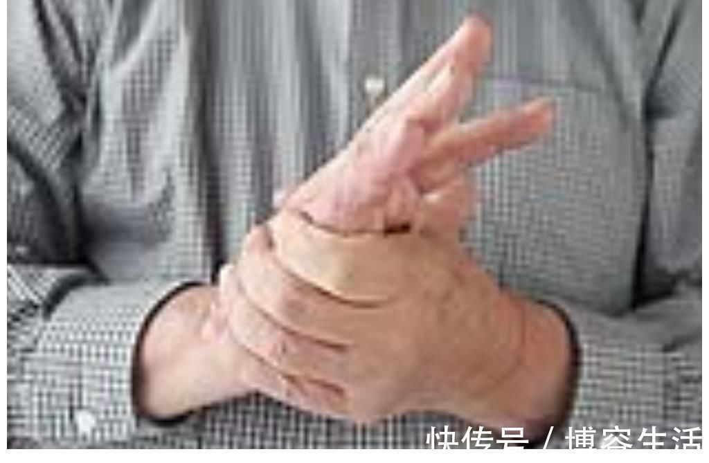 心脑血管疾病|每天吃苹果可以降血脂?北大教授:大错特错,真正降血脂的是3事