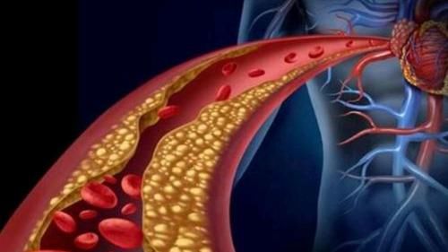 丰隆穴|血脂高要怎么调理？用好这4个方法，或许有助于稳定血脂水平