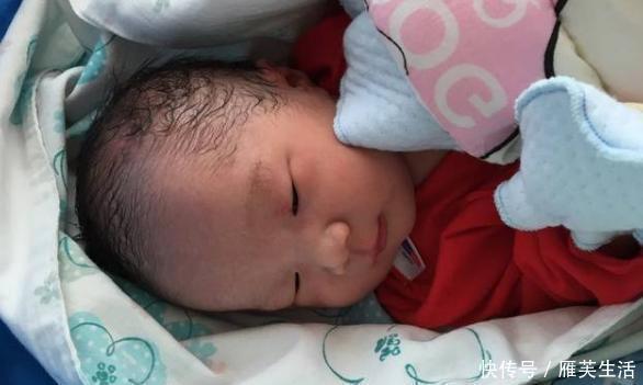 手术|28岁孕妇子宫被胎儿“踢破”,母子险些丧命,只因之前做过这事