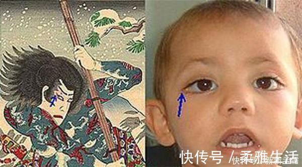 大眼睛|有一种病叫“娃太漂亮”,长得像洋娃娃不一定是好事,父母要小心