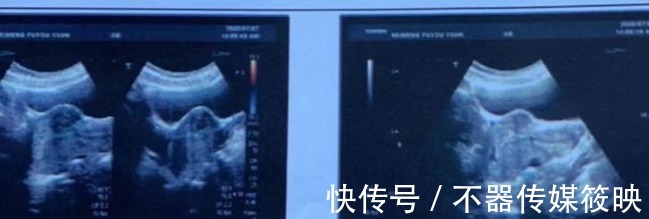 盆底肌|新妈必读!孕期务必小心的五大注意事项!不看当心“害娃又害己”